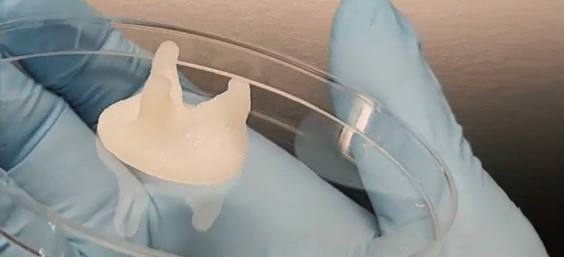 Development of 3D bioprinted heart valves