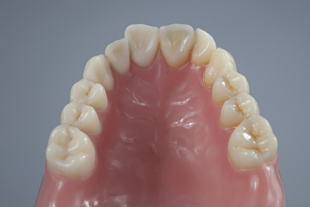 Resin dentures bases